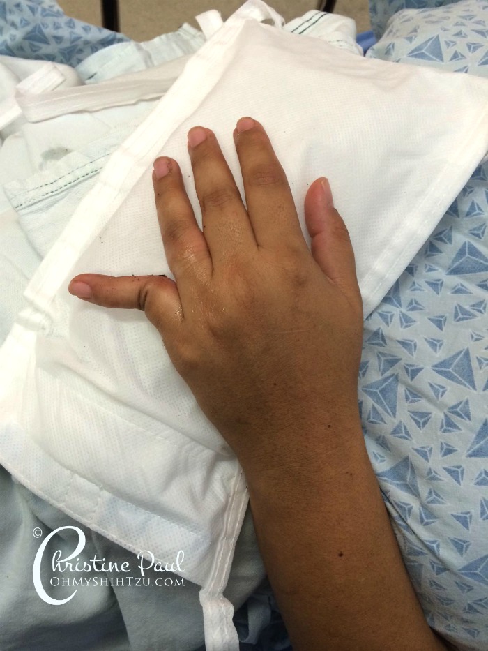 rogue wave causes dislocated finger